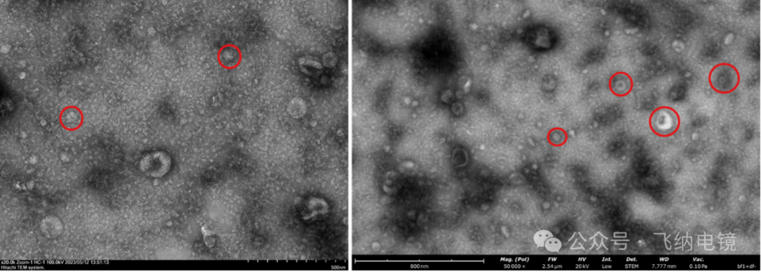左：外泌體（TEM）；右：外泌體（Pharos STEM）